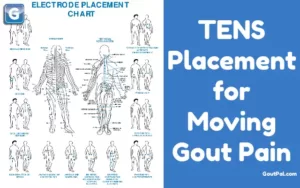 TENS Placement Complicated in Gout